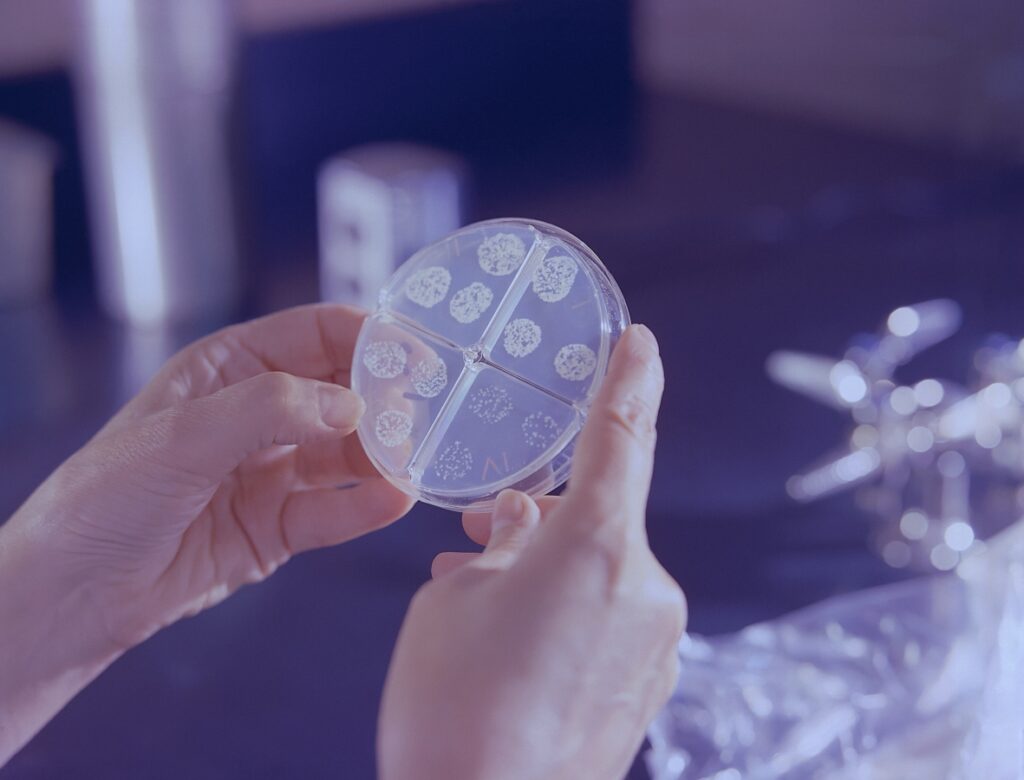 petri dish with bacterial colonies