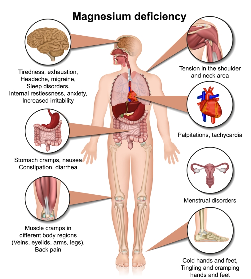 A diagram of the human body and the health concenrs of the magnesium deficiency in the brain (tiredness, exhaustion, headache, migraine) neck area ( tention), heart (palpitations, tachycardia), gastroinestinal (stomach cramps, nausea, constipation, diarrhea), menstrual disorders, muscle cramps in different body regions and cold hands.