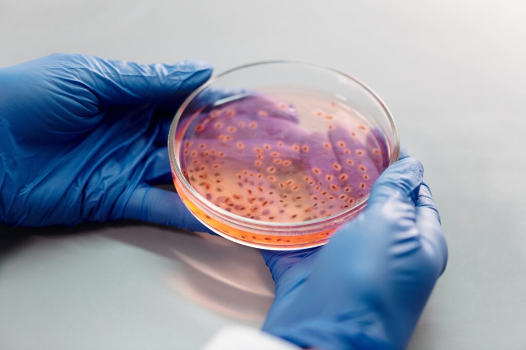 A person with nitrile gloves holding a petri dish full with bacterial colonies