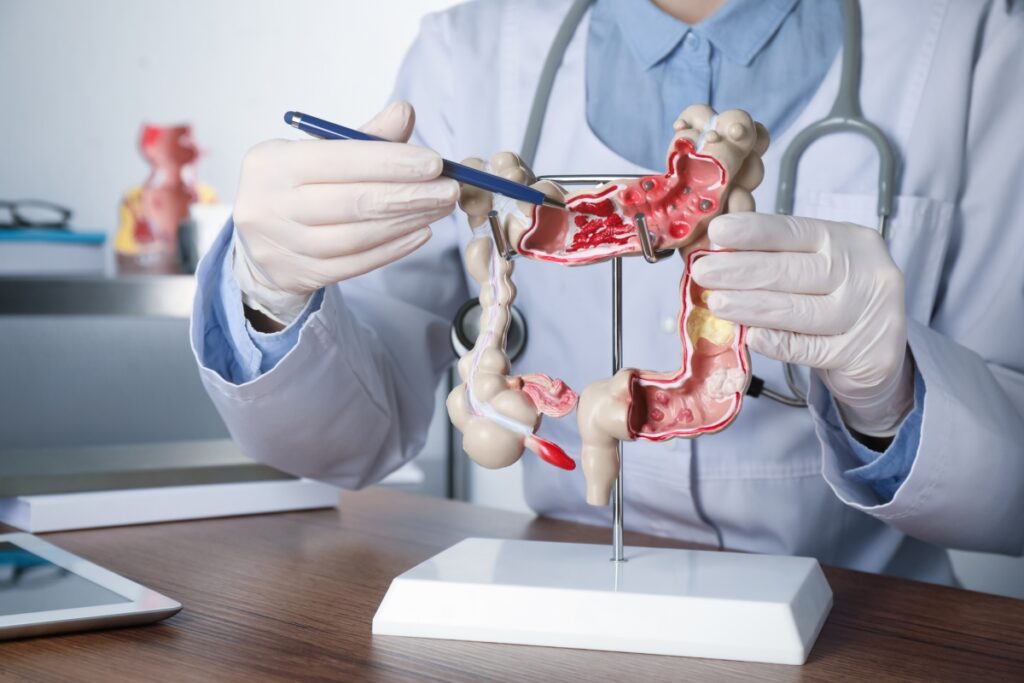 a health practitioner showing a diagram of the human large intestine