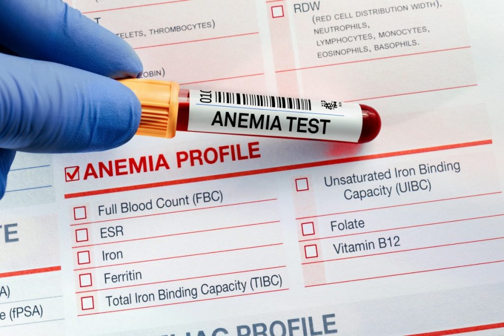 Blood sample for analysis of Anemia profile test in laboratory