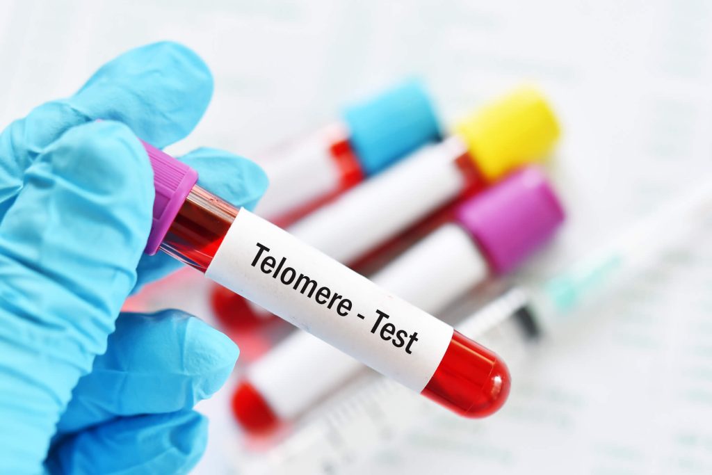 Test tube with blood sample for telomere test, anti-aging prognosis