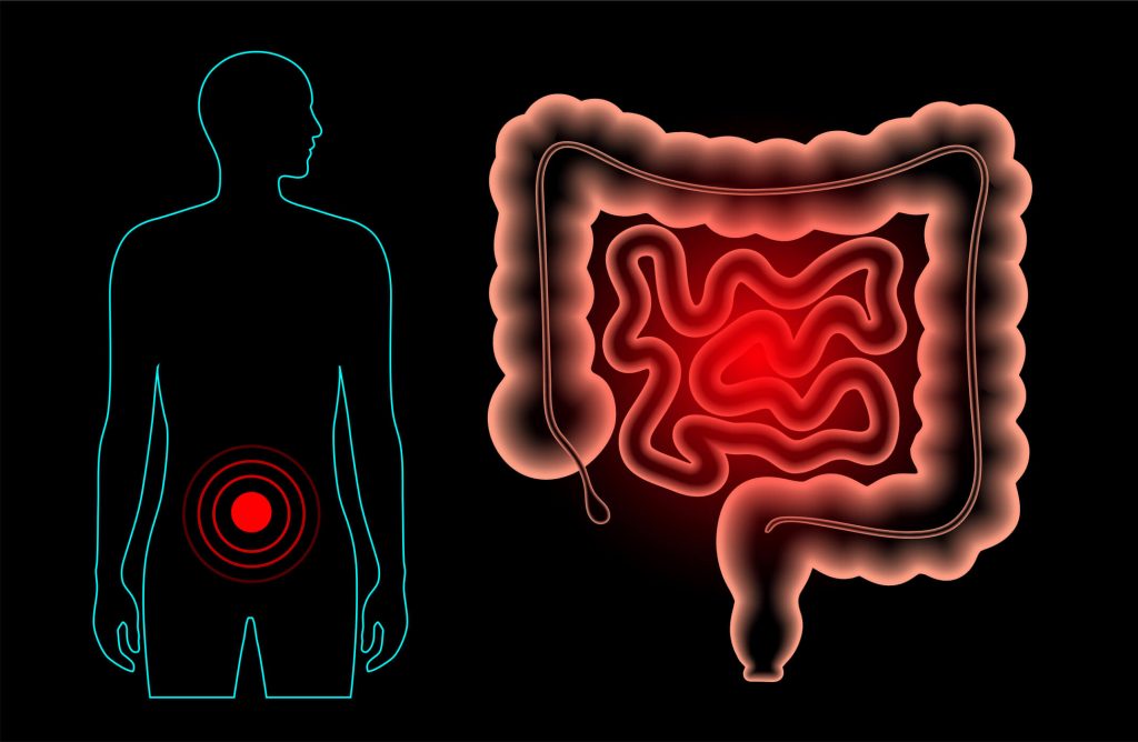 Bowel illustration