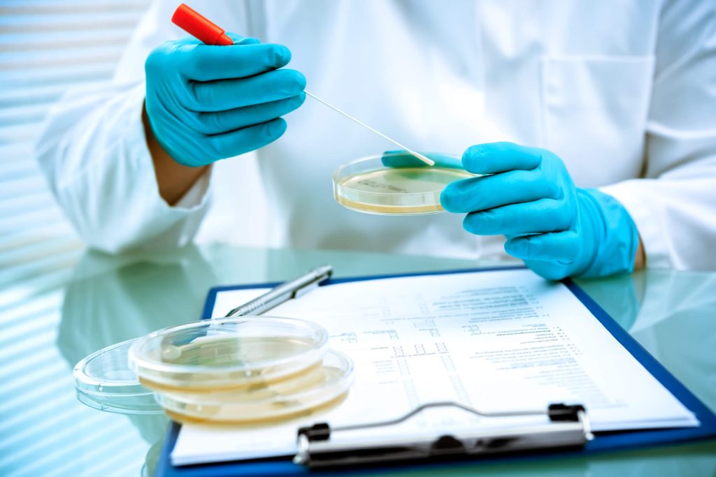 Germs growing on an agar plate in laboratory