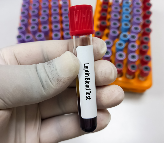 Blood sample for Leptin test.