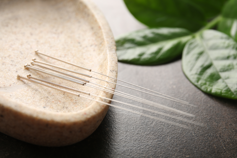Traditional Chinese Medicine and Acupuncture: How to balance your Qi to sleep through the night