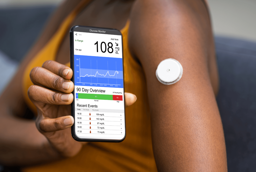 continuos glucose monitoring chart