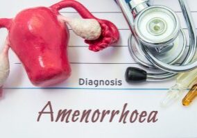Diagnosis of Amenorrhea. Medical history of patient with diagnosis of Amenorrhea inscription next to stethoscope, uterus with ovaries figure, ampoule with medicine. Treatment and diagnostic concept