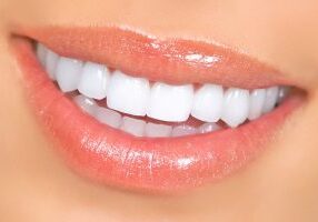 Smiling woman mouth with great teeth. Close up