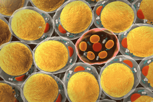 What are Fat Genes? And How to Lose Genetic Fat