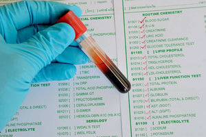 Medical Tests For Better Health: Disease Prevention With Health Tests