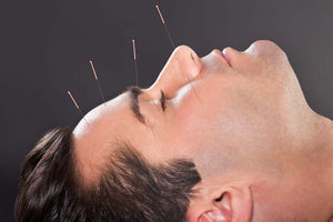 Acupuncture & Acupressure – How Do They Work & What Are The Benefits?