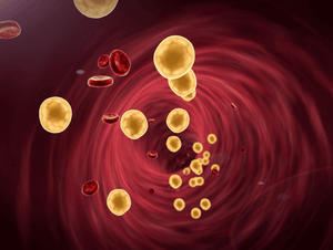 Surprising Causes of High Cholesterol, Genetics, Lifestyle, Nutrients, and More